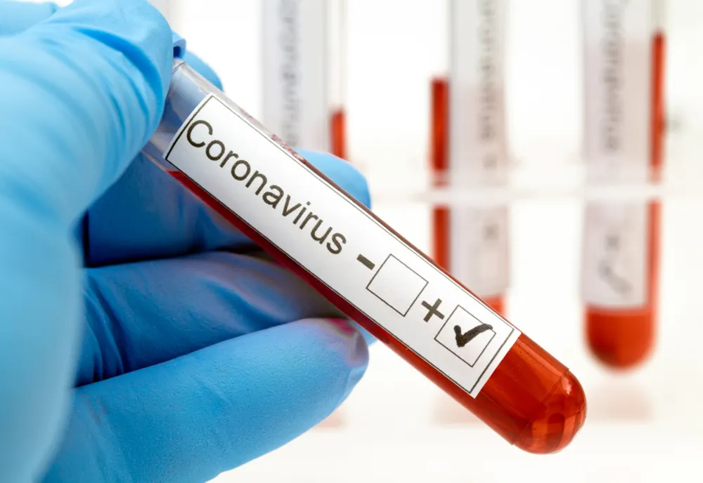 Încă un giurgiuvean infectat cu coronavirus. Numărul cazurilor a ajuns la 212