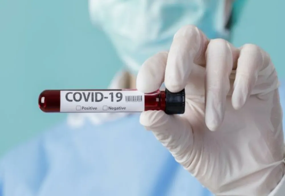 COVID -19. 2.121 de noi cazuri, în țară. În ce județe sunt cei mai mulți infectați