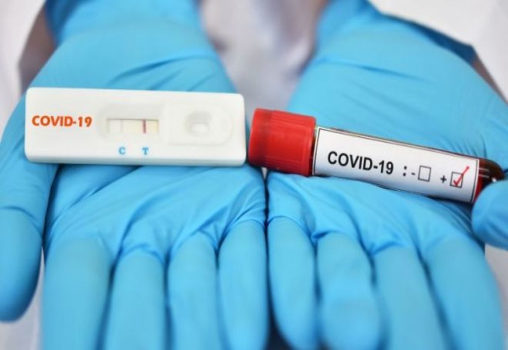 Avertisment: Nu cumpărați teste de imunitate pentru COVID-19 de pe internet! 