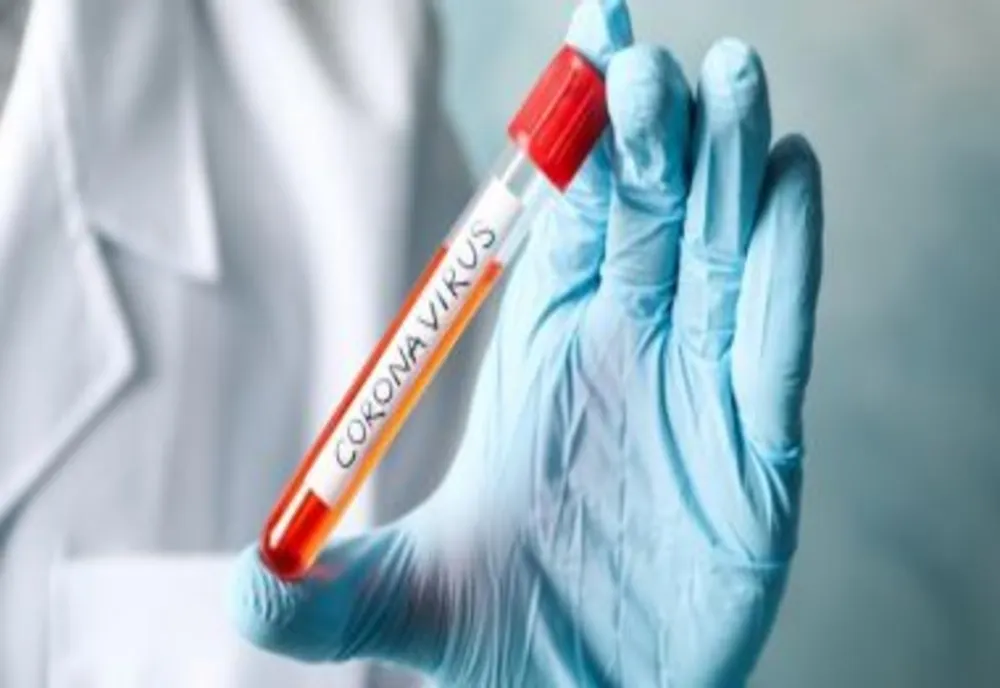 Măsuri pentru limitarea și prevenirea posibilelor îmbolnăviri cu coronavirus
