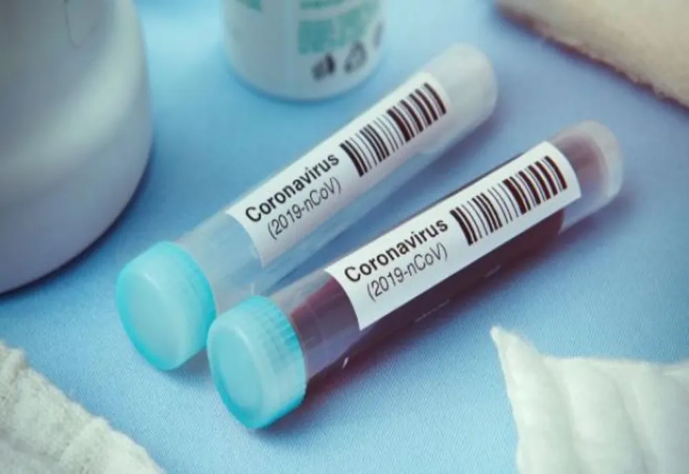 Giurgiuveancă infectată cu coronavirus după ce a mers la dializă