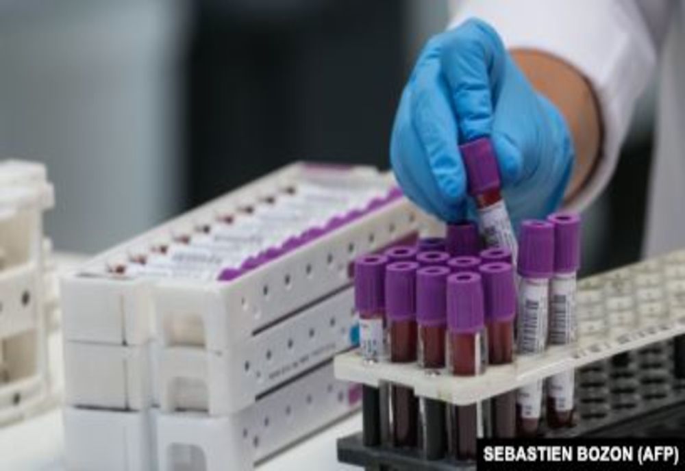 ALARMANT: 416 de noi cazuri de infectare cu COVID-19 în România