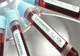 201 cazuri de infectaţi cu COVID 19, la Giurgiu. Cartier întreg, în carantină